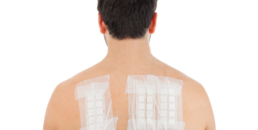 Skin Allergy Patch Test on Bacck